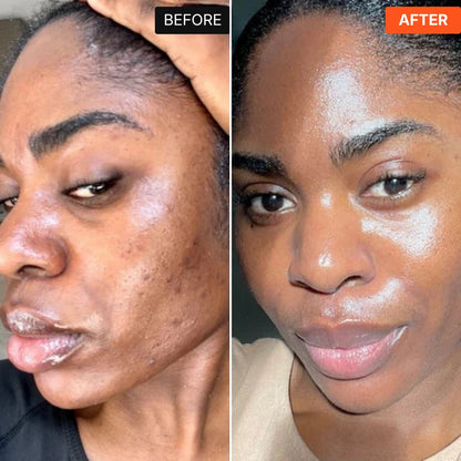 Dr.Korea PDRN & Peptide-8 Glass Skin Serum