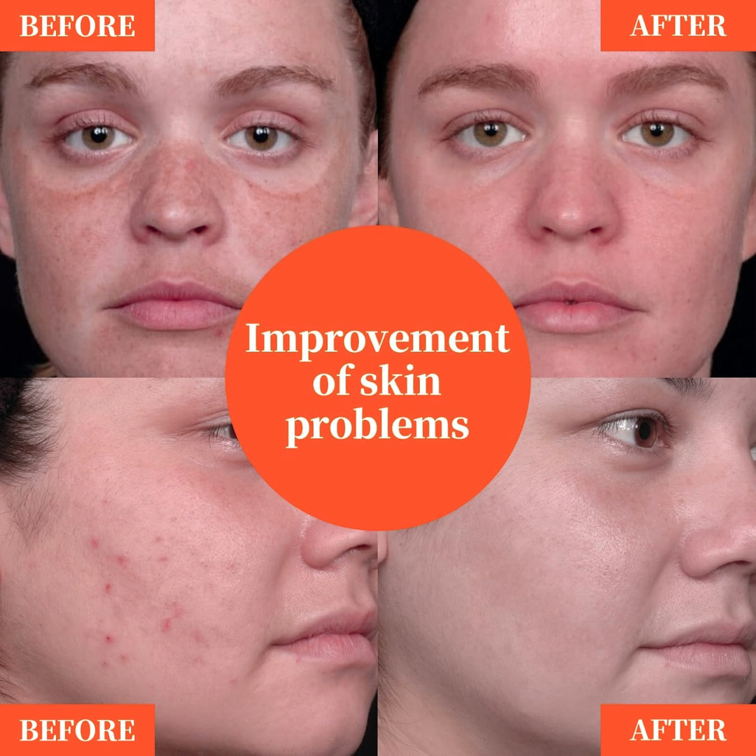 5x Vitamin C Morning Glow Serum
